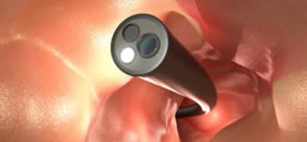 colonoscopia em BH 3